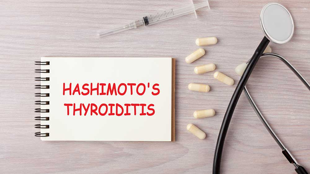 Hashimoto's Thyroiditis | Total Health Center VB