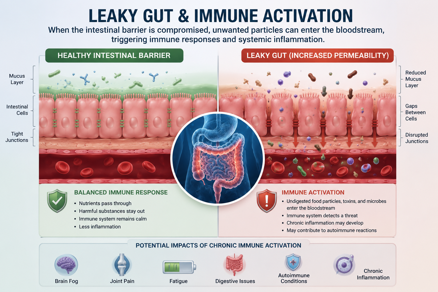 Educational infographic comparing a healthy intestinal barrier to leaky gut and showing how increased intestinal permeability may contribute to immune activation
